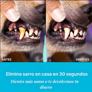 CEPILLO IRRIGADOR 3 EN 1 - Removedor de sarro seguro